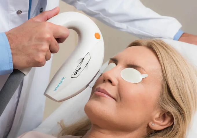 IPL dry eye treatment